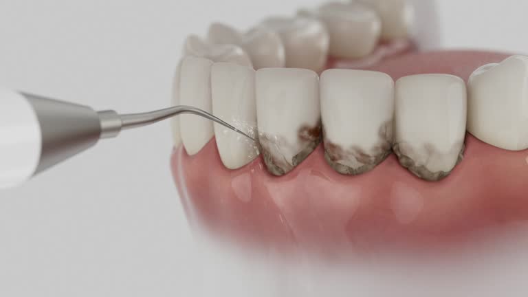 Trusted Root Canal Treatment service in Brownlee Park, MI - Dentist Open Now